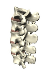 pathologie-de-la-colonne-vertebrale